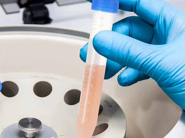 Laboratory personnel wearing gloves remove disposable centrifuge tubes after centrifugation processing.