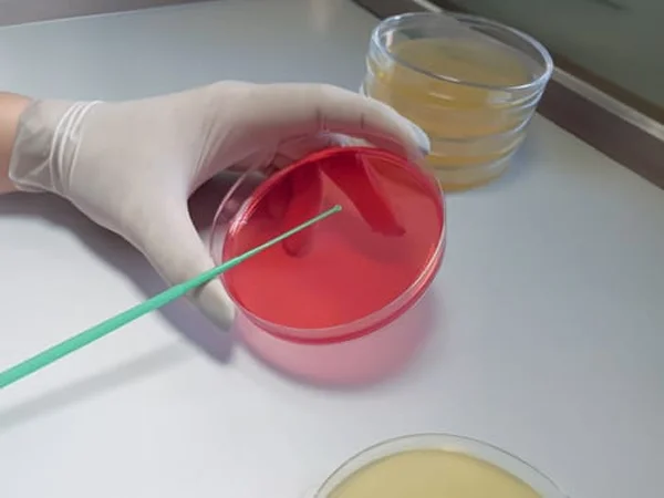 Laboratory personnel use a disposable inoculating loop to sample and inoculate the agar surface.