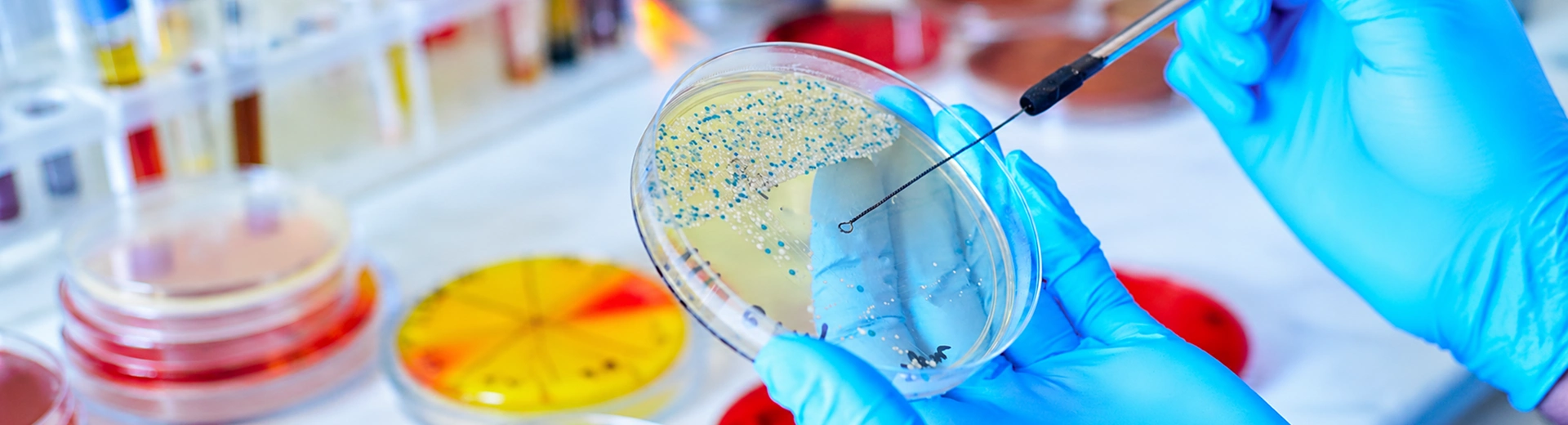 A laboratory technician picks a colony from a petri dish using an inoculating loop.