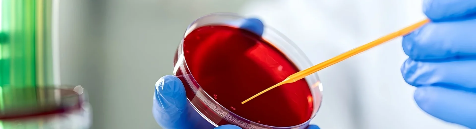 A gloved technician inoculates a red agar plate using an inoculating stick.